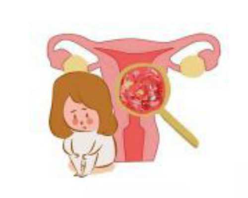 国内私立供卵医院排名第一,试管移植后宫缩是不是会影响着床？移植后怎样感觉是宫缩