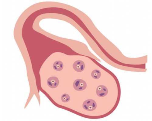 国内借卵试管代生,去上海做试管婴儿要多少钱做试管流程有哪些