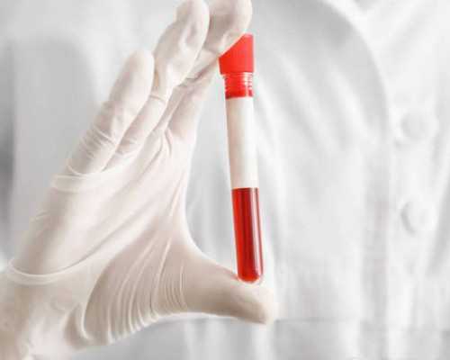 国内有供卵库么,色盲做试管可以有效避免遗传吗想选方案得看看是否符合条件