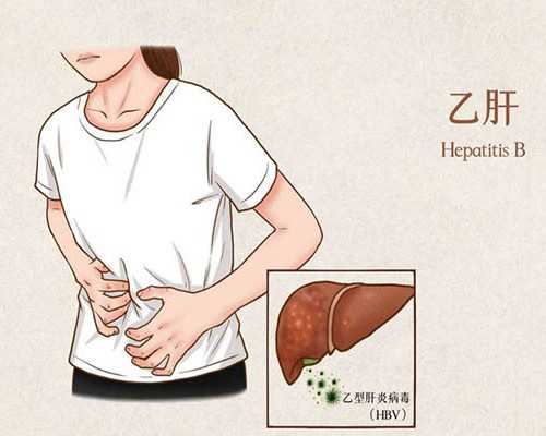 国内代孕中心,孕期3个月检查什么 Nt检查在什么时候